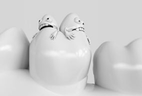 3D Grafik: Bakterien, Vieren und Keime fressen einen Zahn an